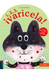 1. 2. 3. ¡Varicela!